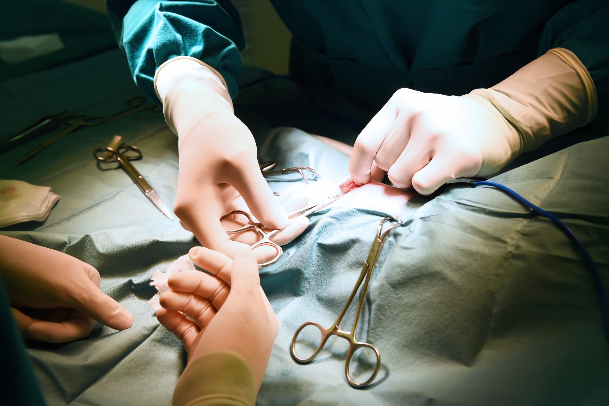 Dr. Anjula Bhargava - Successful Treatment of Endometrial Carcinoma at Rajul Nursing Home